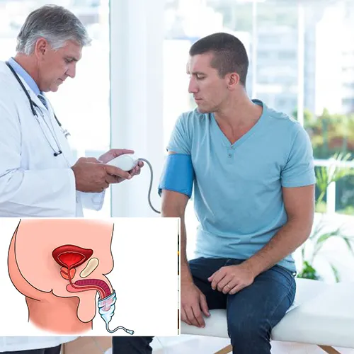 Getting Started with Your Penile Implant Journey